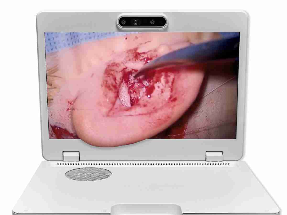 达擎之＂Heads-up 3D显微手术显示系统＂，，，整合4K裸眼3D显示及眼球追踪系统，，具备快速追踪人眼移动位置功能，，，减轻医师长时间维持固定姿势的负担，，，让医师能有更宽广清晰的3D立体视野及更舒适的姿势来执行手术。。。